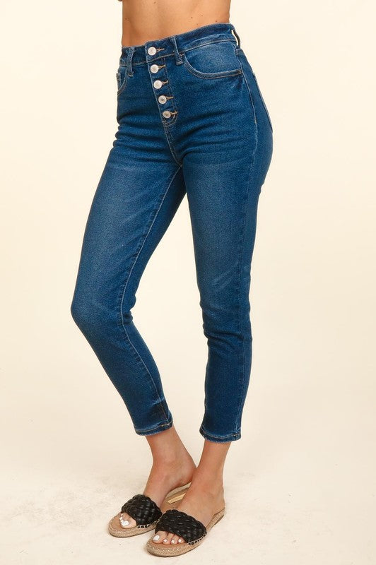 Button Up Skinny Jeans